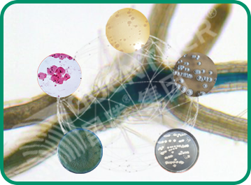 微生物有机菌肥 复合微生物菌剂 复合微生物菌肥